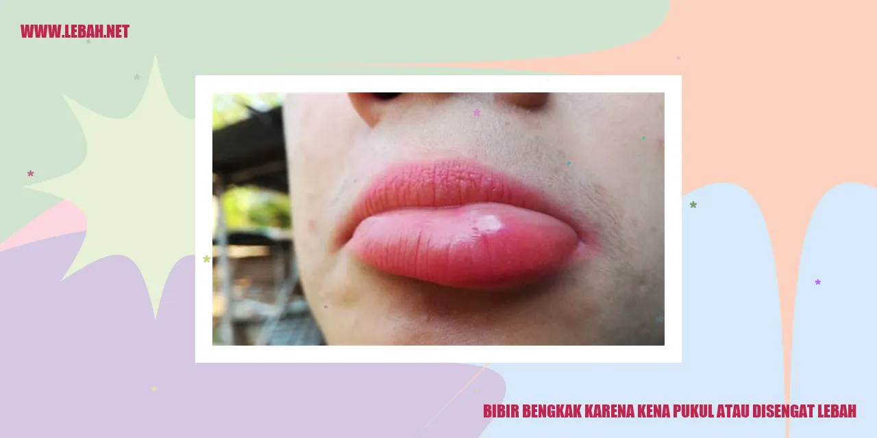 bibir bengkak karena kena pukul atau disengat lebah