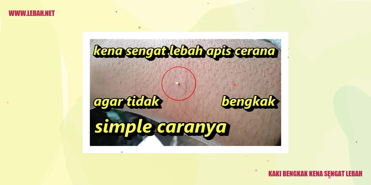 kaki bengkak kena sengat lebah