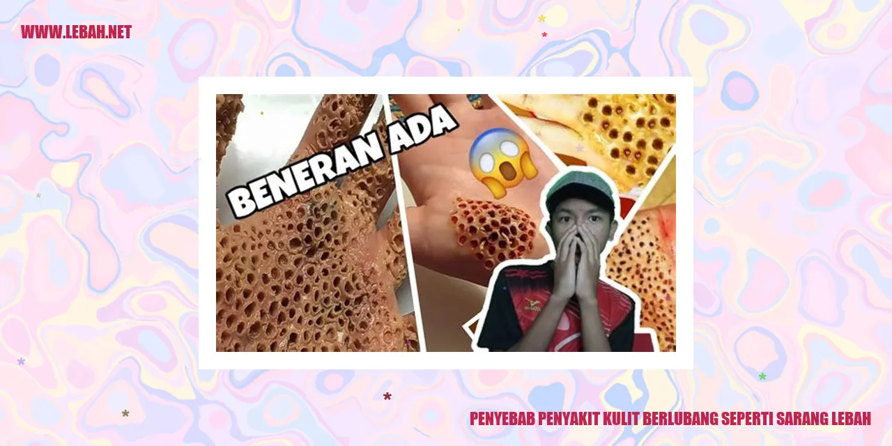 Penyebab Penyakit Kulit Berlubang seperti Sarang Lebah